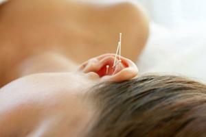 Ušní akupunktura